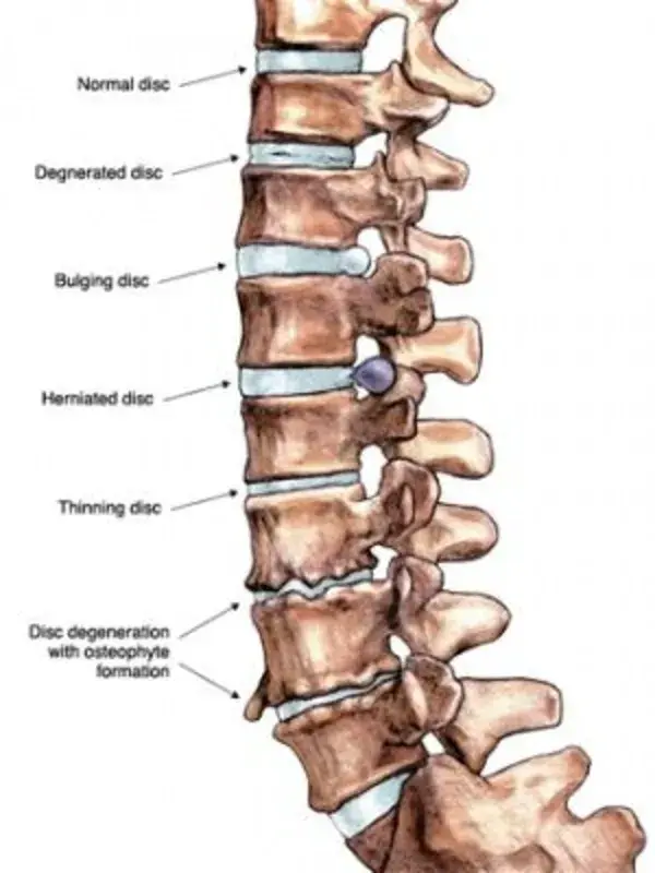 www.spineuniverse.com