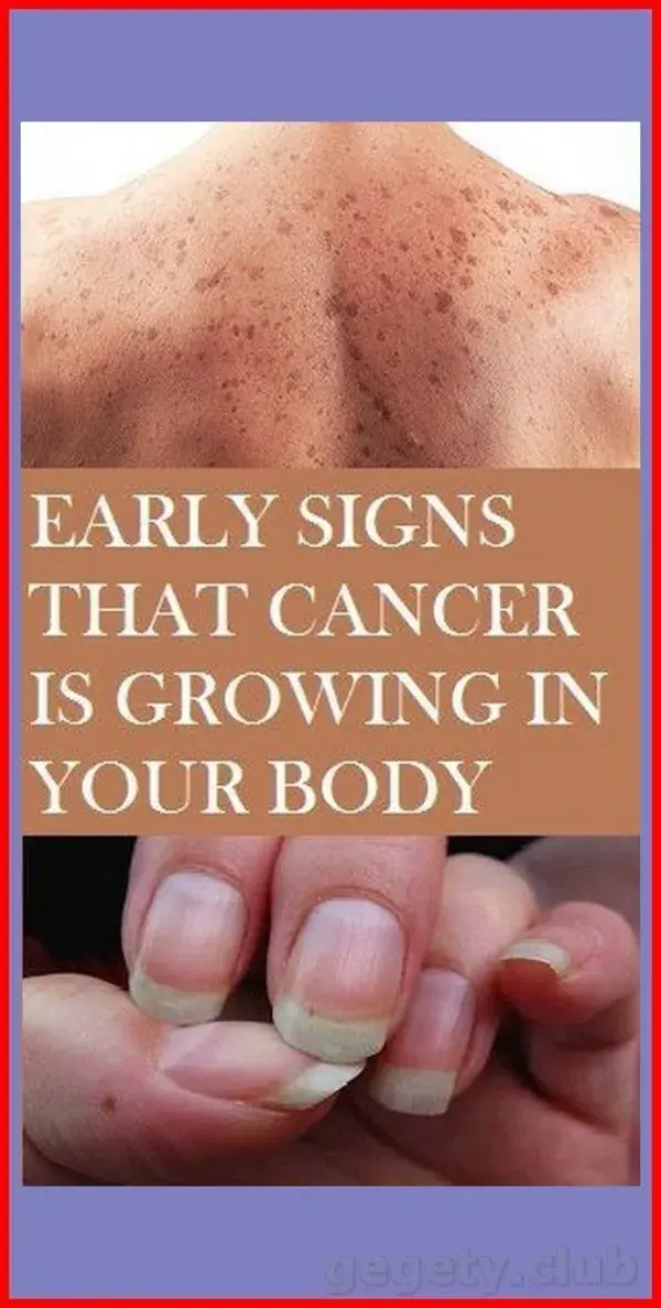 EARLY WARNING SIGNS THAT CANCER IS GROWING IN YOUR BODY!