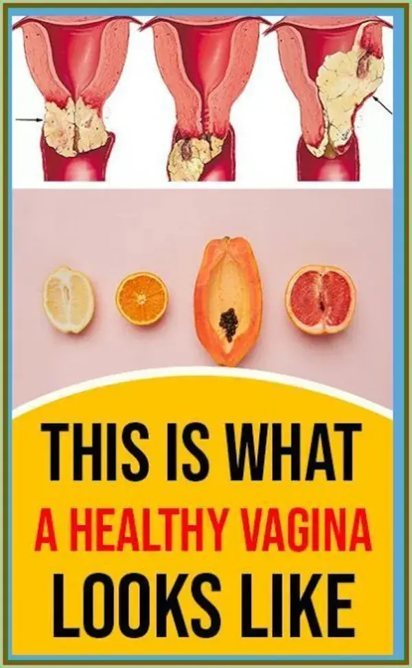 This Is What A Healthy Vagina Looks Like