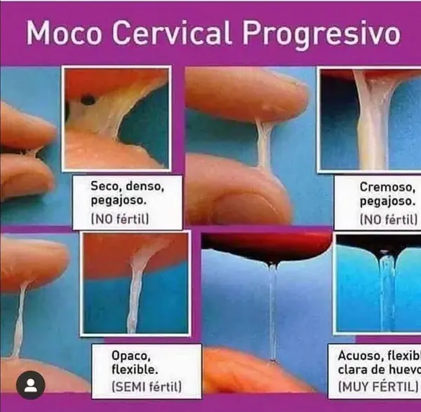 Vaginoplastia, Perineoplastia, Rejuvenecimiento Vaginal.