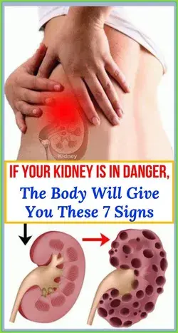 If Your Kidneys Are In Danger, Your Body Will Give You These 7 Signs