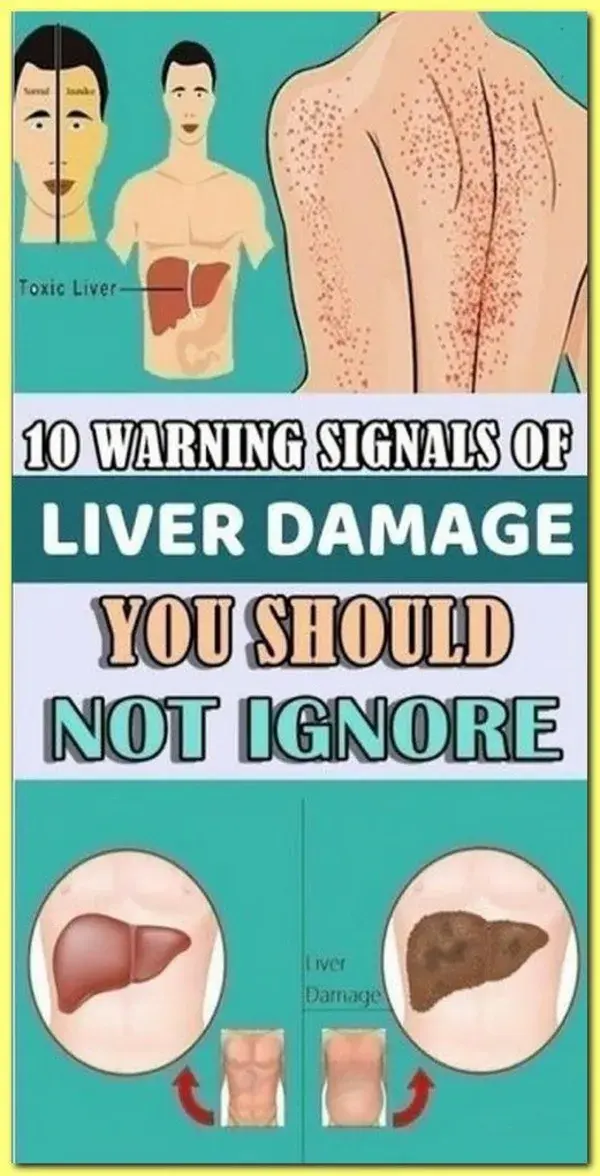 10 Warning Signals of Liver Damage You Should Not Ignore