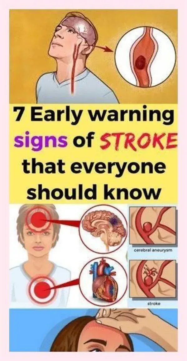 7 Incredibly True Warning Signs Of Stroke !
