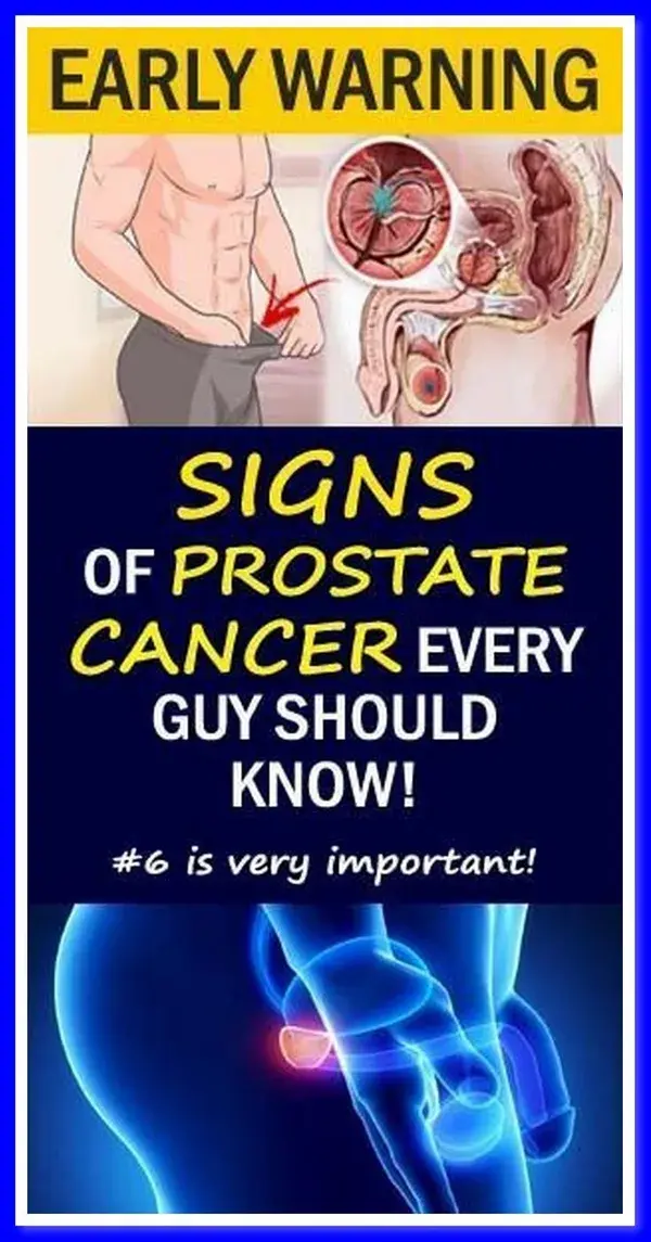 12 EARLY WARNING SIGNS OF PROSTATE CANCER THAT EVERY GUY NEEDS TO KNOW! DO NOT IGNORE