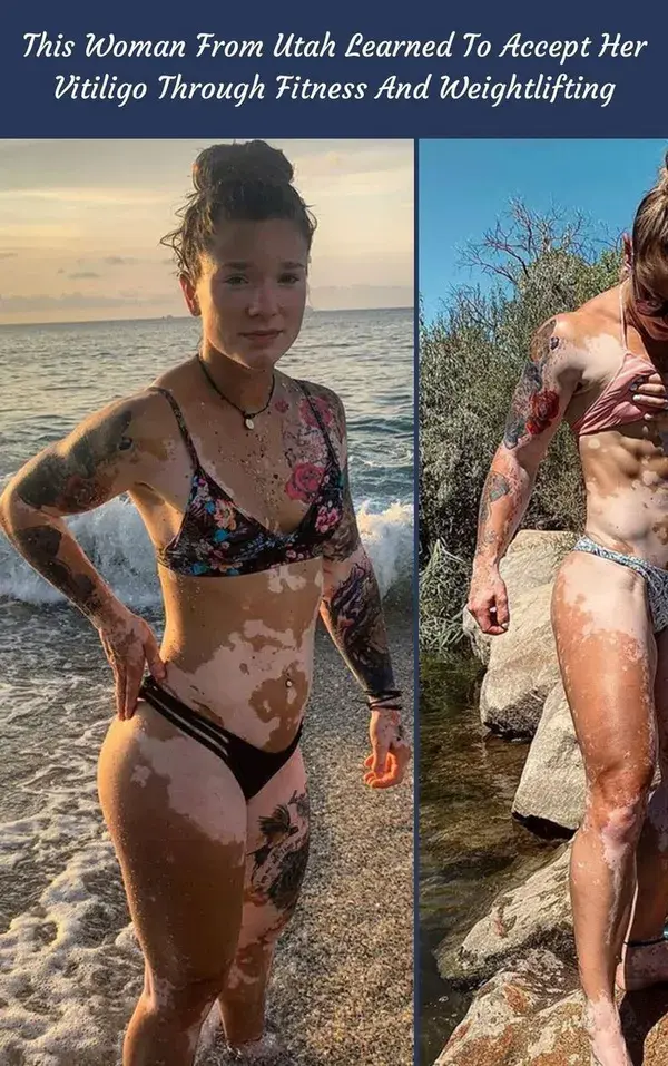 This Woman From Utah Learned To Accept Her Vitiligo Through Fitness And Weightlifting