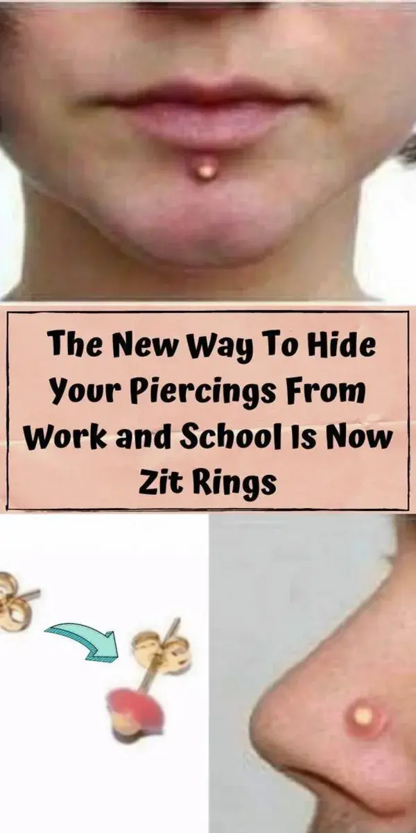 The New Way To Hide Your Piercings From Work and School Is Now Zit Rings