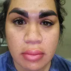 My microblading was so bad that people are donating money to help fix it – but the technician says she did nothing wrong