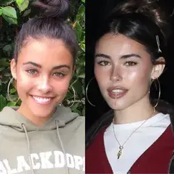 Madison Beer  plastic surgery