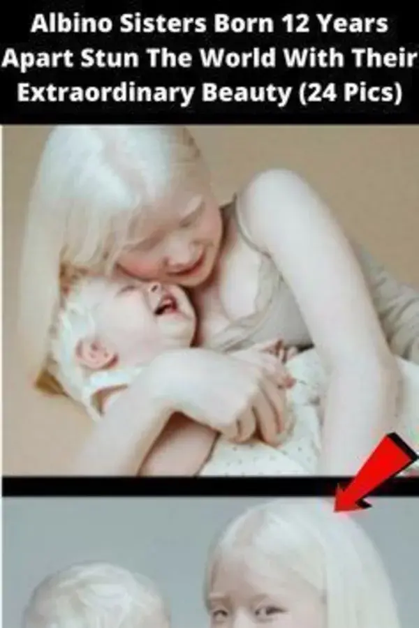 Albino Sisters Born 12 Years Apart Stun The World With Their Extraordinary Beauty (24 Pics)