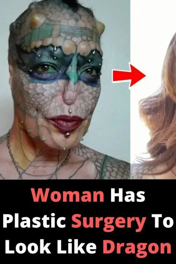 Woman Has Plastic Surgery To Look Like Dragon 