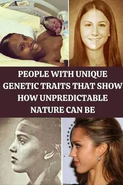 People With Unique Genetic Traits That Show How Unpredictable Nature Can Be