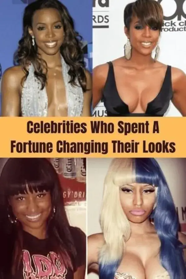 Celebrities Who Spent A Fortune Changing Their Looks