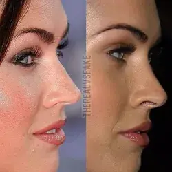 Megan Fox: Before & After Nose Job (2007)
