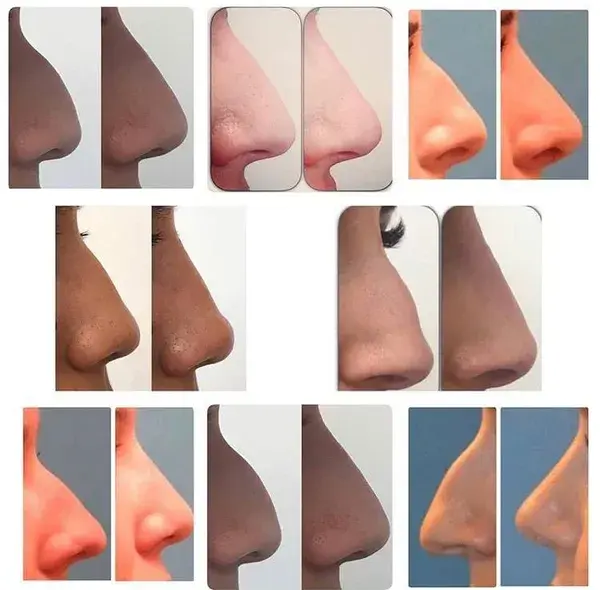 www.utahfacialplastics.com