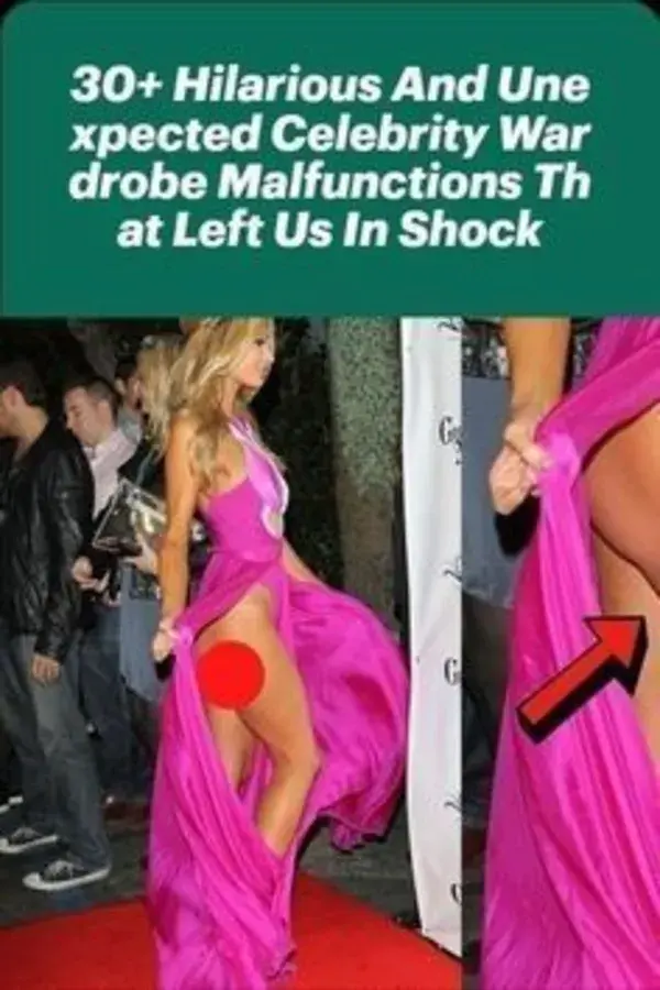 Hilarious And Unexpected Celebrity Wardrobe Malfunctions