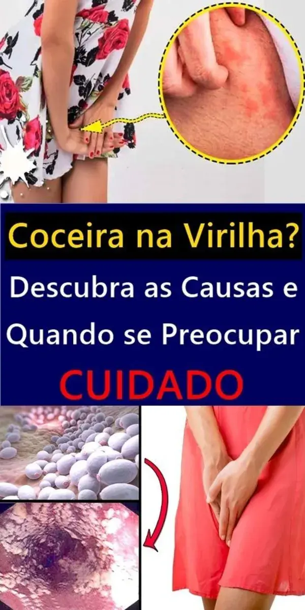 Coceira na Virilha? Descubra as Causas e Quando se Preocupar!