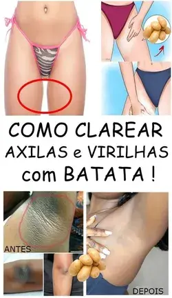 Passe Isso Para Clarear Virilha e Axilas!