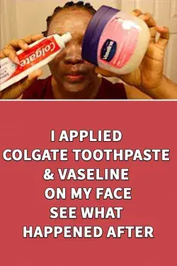 I APPLIED COLGATE TOOTHPASTE & VASELINE ON MY FACE, SEE WHAT HAPPENED AFTER 