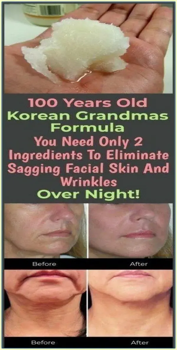 YOU NEED ONLY 2 INGREDIENTS TO ELIMINATE SAGGING FACIAL SKIN AND WRINKLES OVER NIGHT