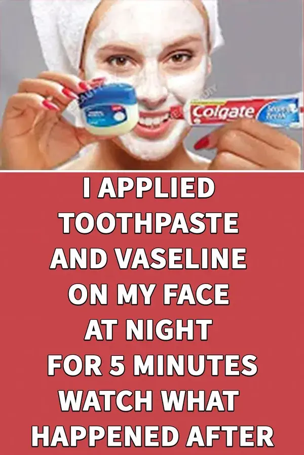 I APPLIED TOOTHPASTE AND VASELINE ON MY FACE AT NIGHT FOR 5 MINUTES, WATCH WHAT HAPPENED AFTER 