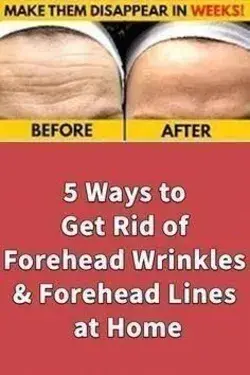 How To Reduce Forehead Wrinkles