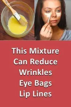 This formula will help you how to get rid of wrinkles around eyes quickly and effectively
