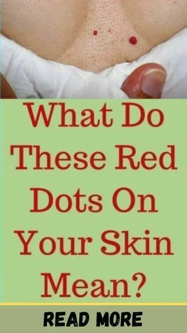 What Do These Red Dots On Your Skin Mean?