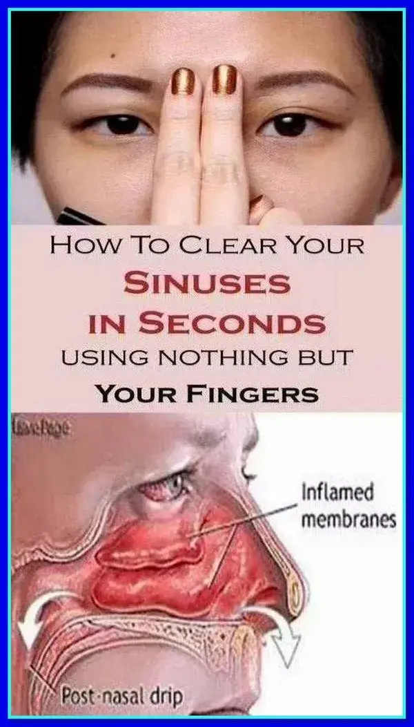 How to Clear Your Sinuses in Seconds Using Nothing But Your Fingers