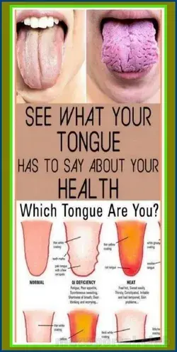 WHAT DOES YOUR TONGUE SAY ABOUT YOUR HEALTH?