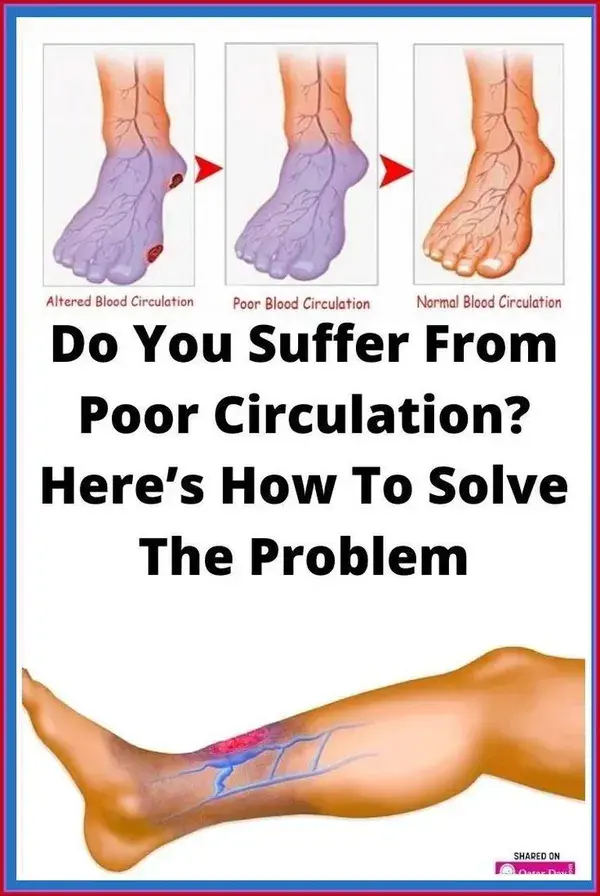 Do You Suffer From Poor Circulation? Here’s How To Solve The Problem