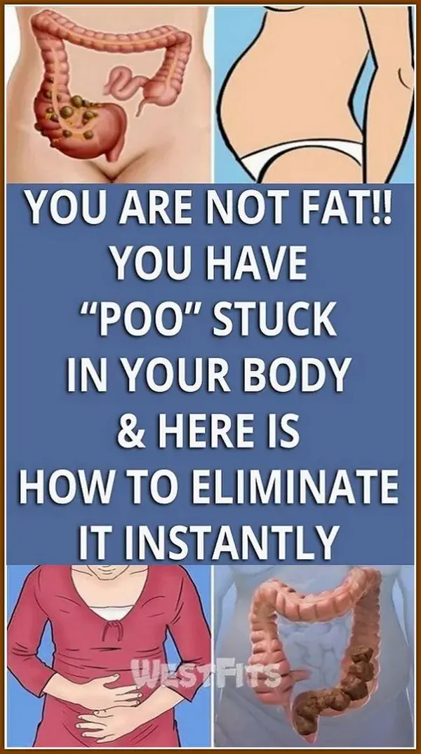 YOU HAVE �POO� STUCK IN YOUR BODY & HERE IS HOW TO ELIMINATE IT INSTANTLY