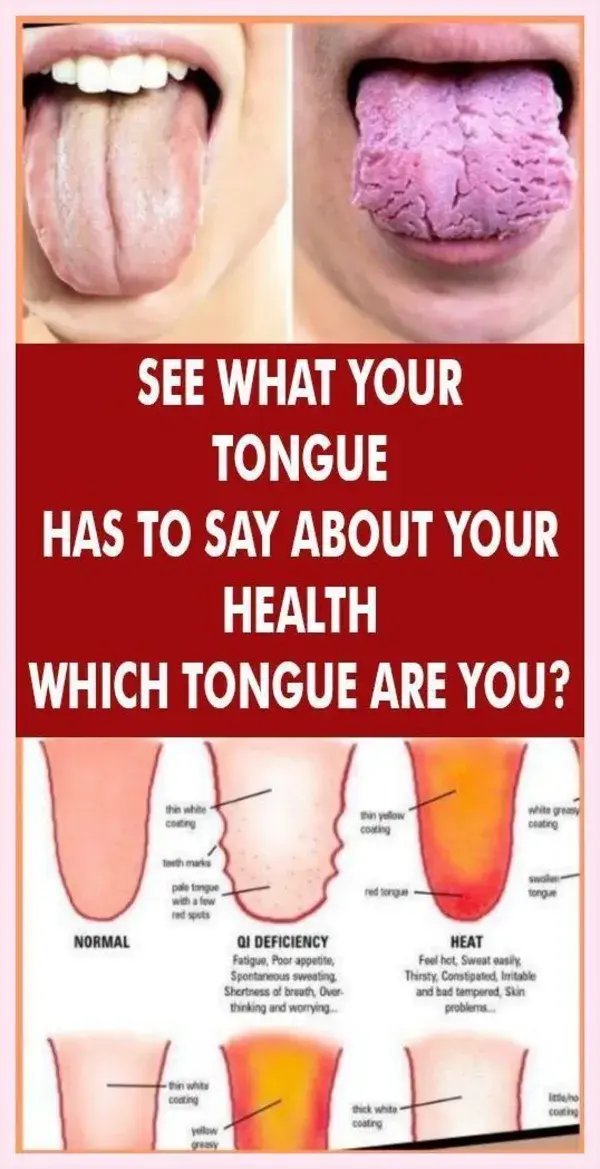 WHAT YOUR TONGUE IS TRYING TO TELL YOU ABOUT YOUR HEALTH