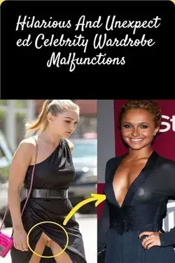 Hilarious And Unexpected Celebrity Wardrobe Malfunctions