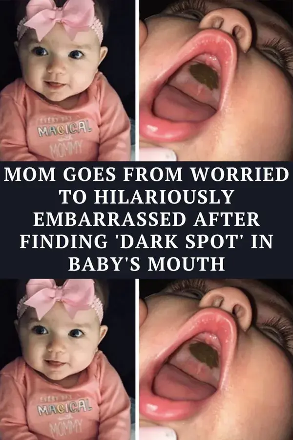 Mom goes from worried to hilariously embarrassed after finding 'dark spot' in baby's mouth