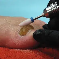 The most unbelievable pedicure transformation