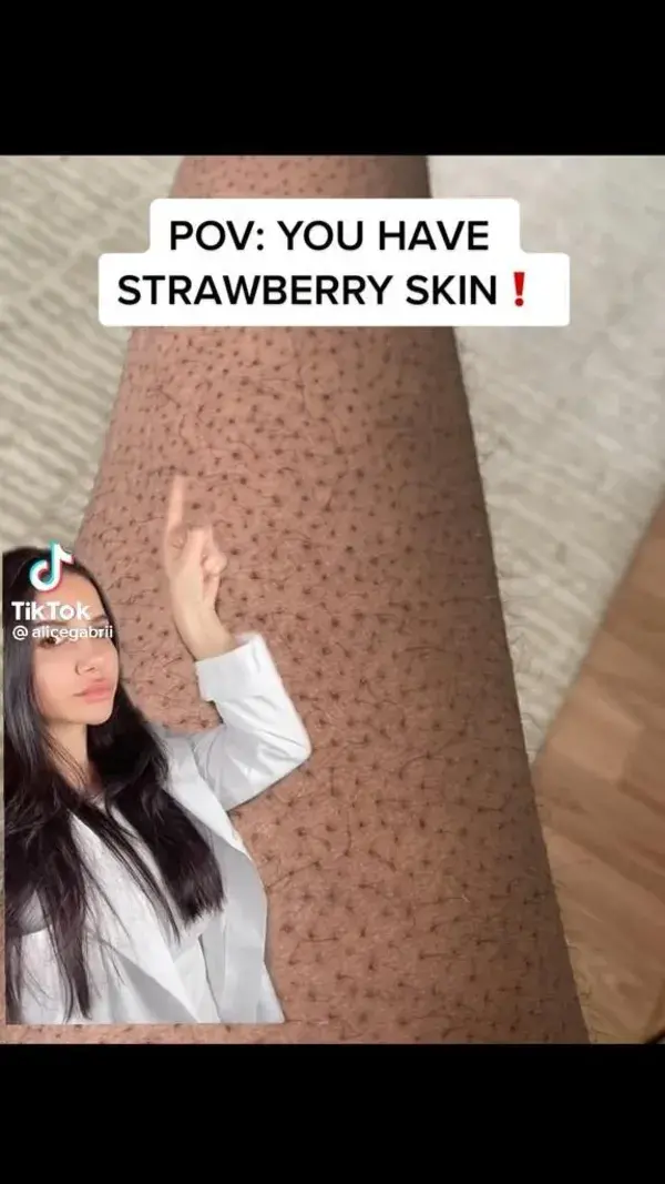 Strawberry legs