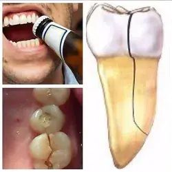 HOW TO strengthen teeth