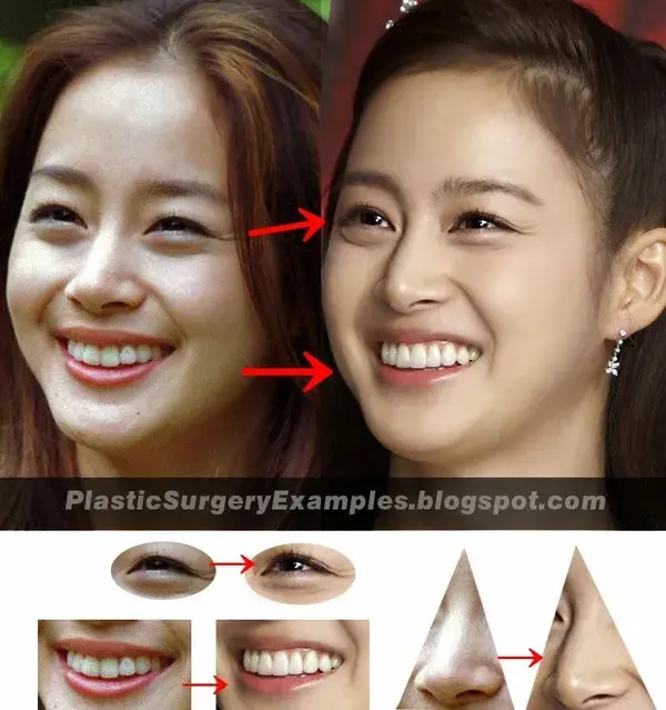 plasticsurgeryexamples.blogspot.com