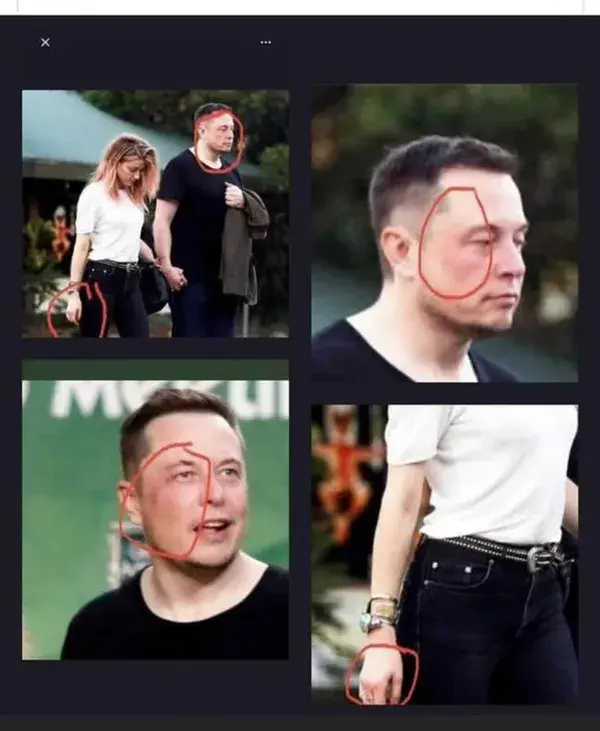 Elon Musk photographed with injuries while dating Amber Abuser Heard