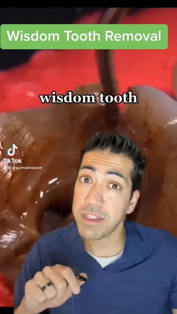 Not all Wisdom teeth needs to be removed surgically