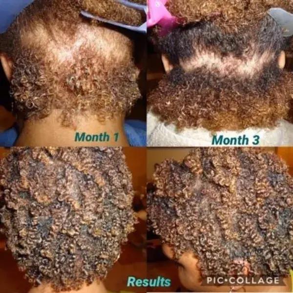 The Bundle that Makes your Hair Grow?