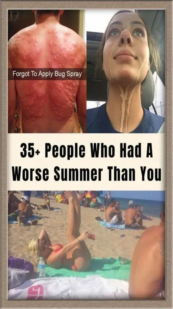 35+ People Who Had A Worse Summer Than You