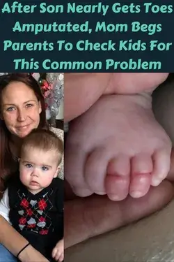 After Son Nearly Gets Toes Amputated, Mom Begs Parents To Check Kids For This Common Problem