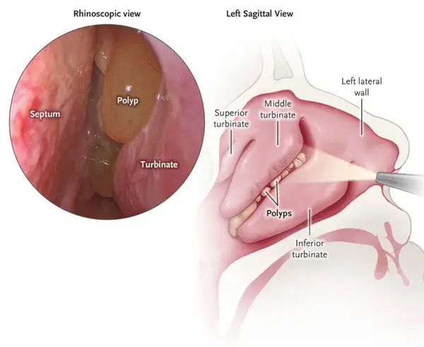 my.clevelandclinic.org