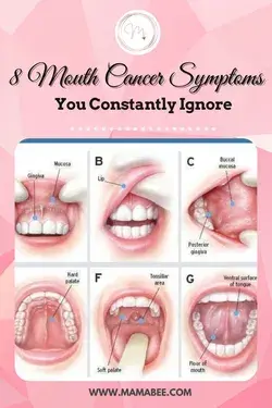 8 Mouth Cancer Symptoms You Constantly Ignore