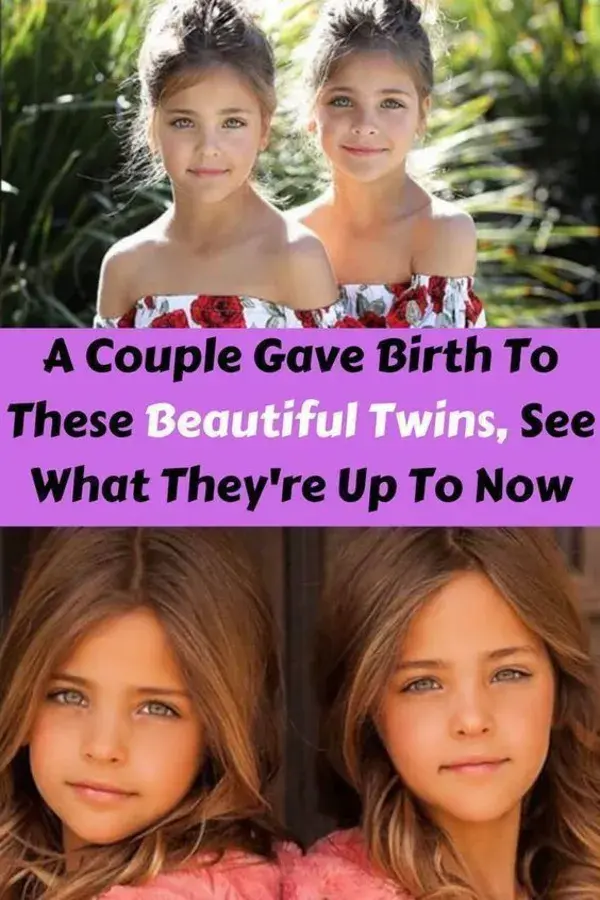 A Couple Gave Birth To These Beautiful Twins, See What They're Up To Now