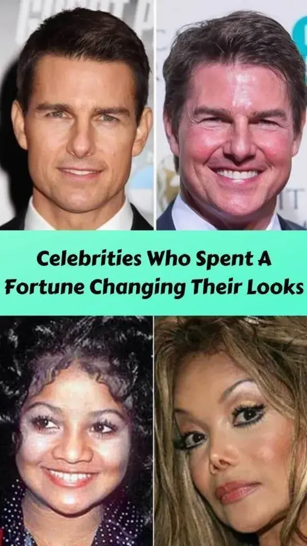 Celebrities Who Spent A Fortune Changing Their Looks