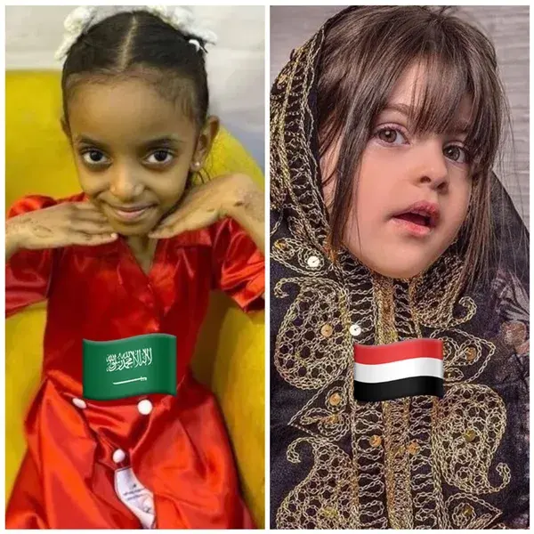 الجمال السعودي vs الجمال اليمني