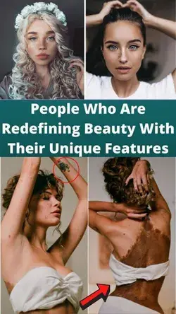 People Who Are Redefining Beauty With Their Unique Features