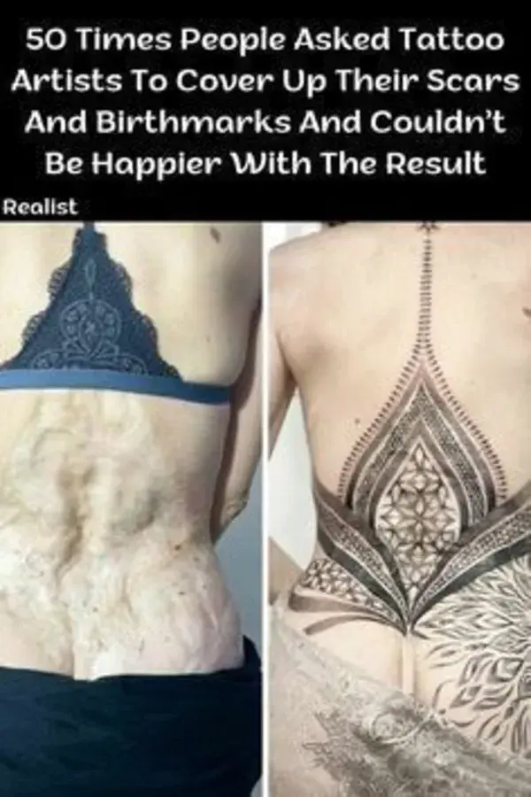 50 Times People Asked Tattoo Artists To Cover Up Their Scars And Birthmarks